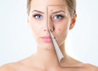 تخلّصي من حبّ الشباب مع هذه الخلطات الطبيعية المضمونة!