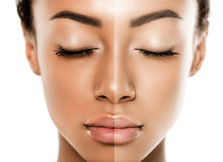 جرّبي هذا الماسك الطبيعيّ لتفتيح البشرة في أيّام!