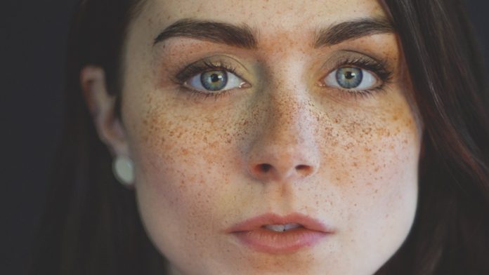 fake_freckles.jpg.optimal