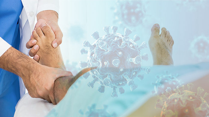 is_200624_guillain_barre_syndrome_legs_covid_800x450