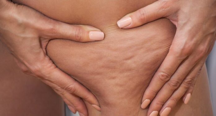 650x350_5-ways-to-fight-cellulite-696x374