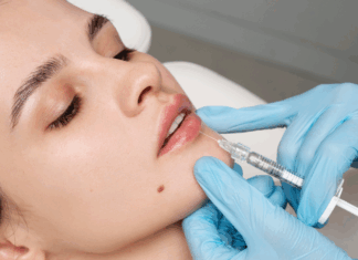 حقن الفيلر